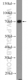 26105-1-AP - Radixin / RDX