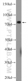 26105-1-AP - Radixin / RDX