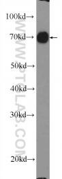 26105-1-AP - Radixin / RDX