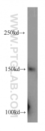17008-1-AP - RecQ4 / RECQL4