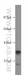 11814-1-AP - RFC3 / RFC38