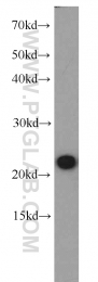 11163-1-AP - RGS10