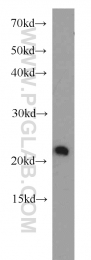 11163-1-AP - RGS10