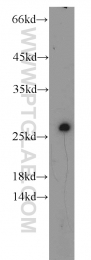 12549-1-AP - RGS17