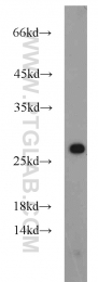 12549-1-AP - RGS17