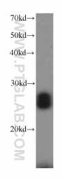 12549-1-AP - RGS17