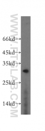 12549-1-AP - RGS17
