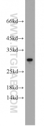 10678-1-AP - RGS2