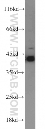 11590-1-AP - RGS5