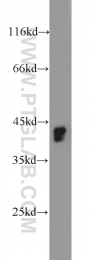 11590-1-AP - RGS5