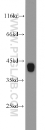 11590-1-AP - RGS5