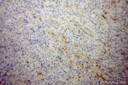 14056-1-AP - RGS7