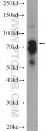 12671-1-AP - Rhophilin 2 / RHPN2