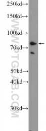 12671-1-AP - Rhophilin 2 / RHPN2