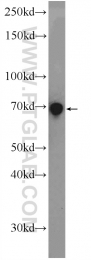 12671-1-AP - Rhophilin 2 / RHPN2
