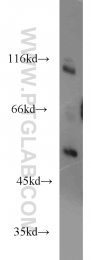 15366-1-AP - RIPK2