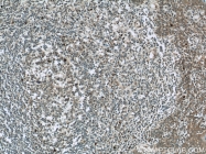 22577-1-AP - RNASEL