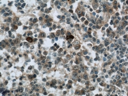 22577-1-AP - RNASEL