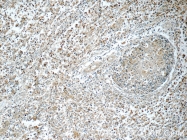 22577-1-AP - RNASEL