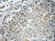 22577-1-AP - RNASEL