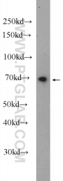 25165-1-AP - ZNF179