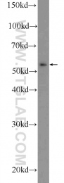 25685-1-AP - TMEM118 / RNFT2