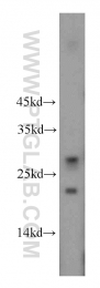 20936-1-AP - DPCD