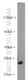 10412-1-Ap - RPA2