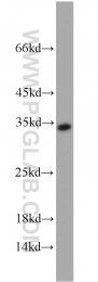 10412-1-Ap - RPA2