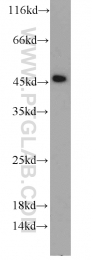 11005-1-AP - RPL3