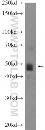 11302-1-AP - RPL4 / RPL1