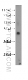 11302-1-AP - RPL4 / RPL1