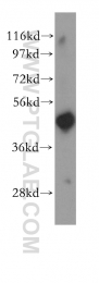 11302-1-AP - RPL4 / RPL1