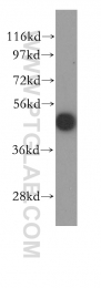 11302-1-AP - RPL4 / RPL1