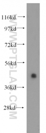 11302-1-AP - RPL4 / RPL1