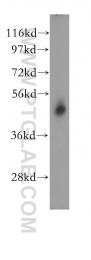11302-1-AP - RPL4 / RPL1