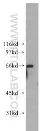 12894-1-AP - Ribophorin-1 / RPN1