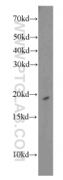 14894-1-AP - RPS10