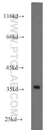 14123-1-AP - RPS3A
