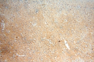 15048-1-AP - Reticulon 1 / RTN1