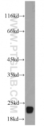 15048-1-AP - Reticulon 1 / RTN1