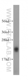 15048-1-AP - Reticulon 1 / RTN1