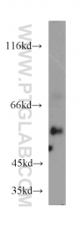 21218-1-AP - RXR-alpha / RXRA