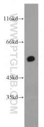 21218-1-AP - RXR-alpha / RXRA