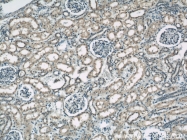 22138-1-AP - Tyrosine-protein kinase RYK