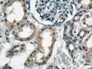 22138-1-AP - Tyrosine-protein kinase RYK