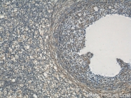 22138-1-AP - Tyrosine-protein kinase RYK