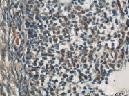 22138-1-AP - Tyrosine-protein kinase RYK