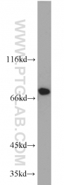 22138-1-AP - Tyrosine-protein kinase RYK
