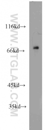 22138-1-AP - Tyrosine-protein kinase RYK